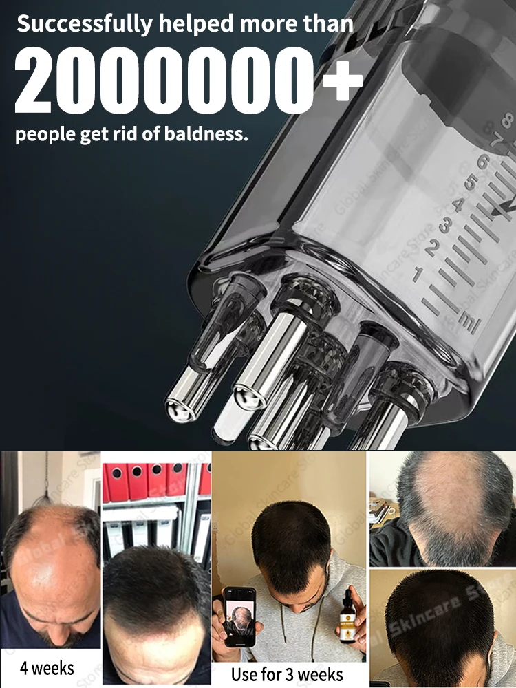 Brosse à cheveux liquide et masseur à rouleaux pour améliorer votre vie, appliquer avec l'huile de croissance des cheveux en 7 jours.