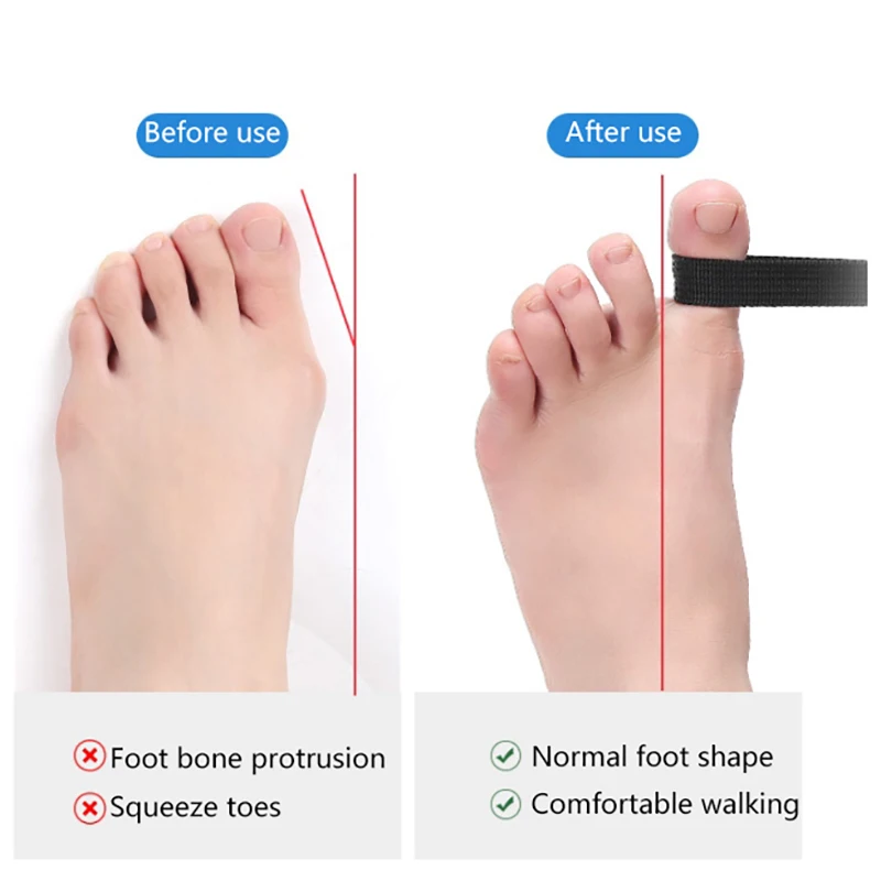 1Pc Toe Straightener Hallux Valgus Corrector Belt Foot Stretch Recovery Training Exerciser Strap Thumb Elastic Band Foot Tools