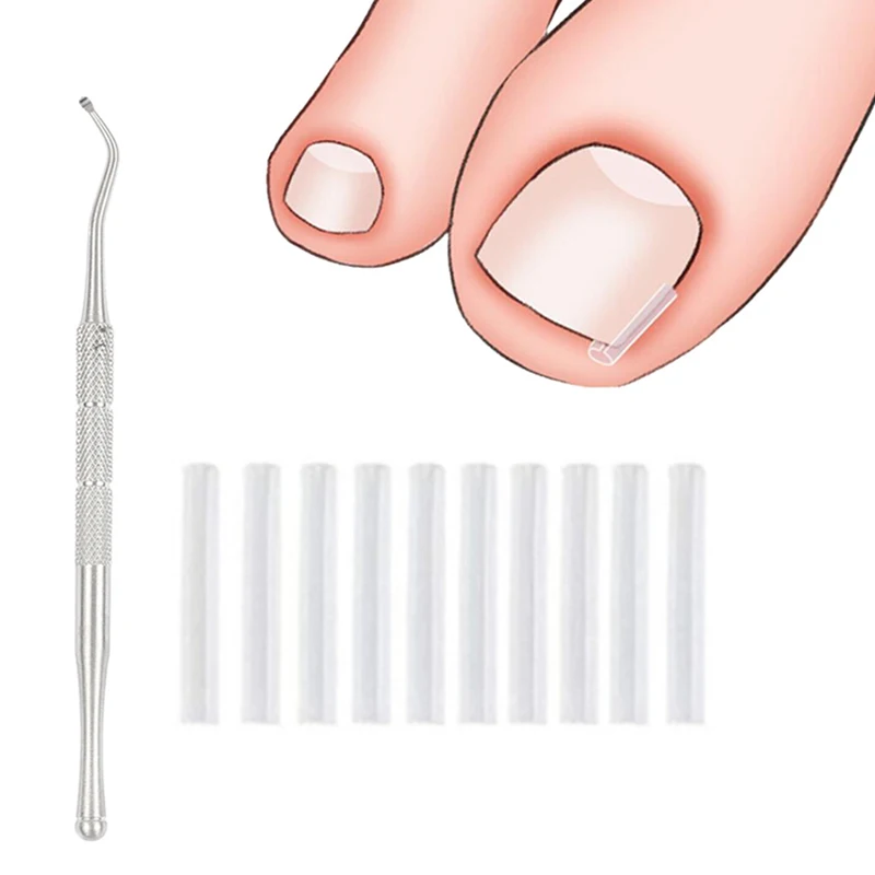 Ingrown Toenail Correction Tool Nail Filling Pad Ingrown Toe Nail Treatment Elastic Patch Straightening Clip Brace Pedicure Tool