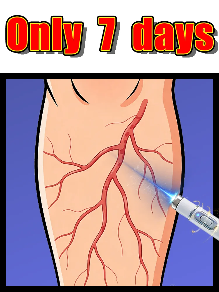 Help people with vein problems caused by prolonged standing Restore operational capability