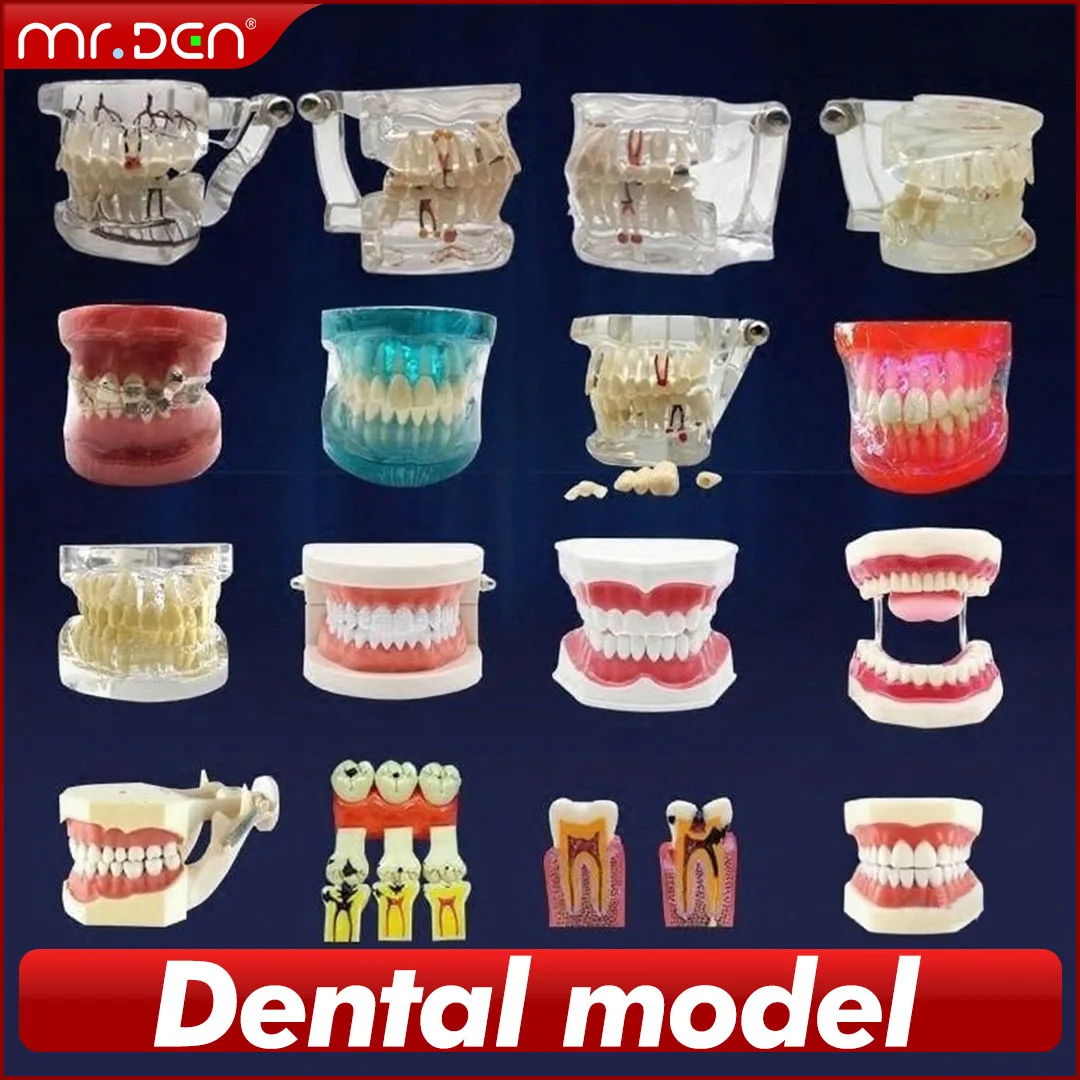 

Multiple Types Dental Model Teeth Hyperrealistic Teaching Study Orthodontic Removable Implant Models Dentist Material