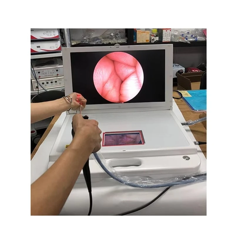 PS046 Medical Gastrocolonoscopy System Video Endoscopy System with Video Gastroscope and Pet and Animal Video Colonoscopy