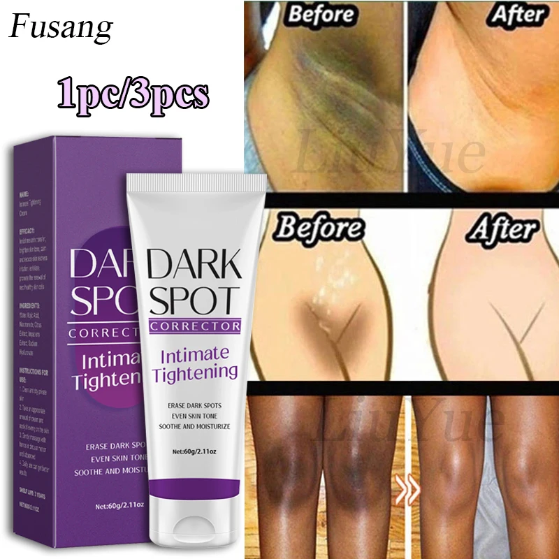 Quickly Private Parts Brightening Cream Dark Skin Underarm Brighten Cream Inner Thighs Elbows Bleach Joint Remove Melanin Cream