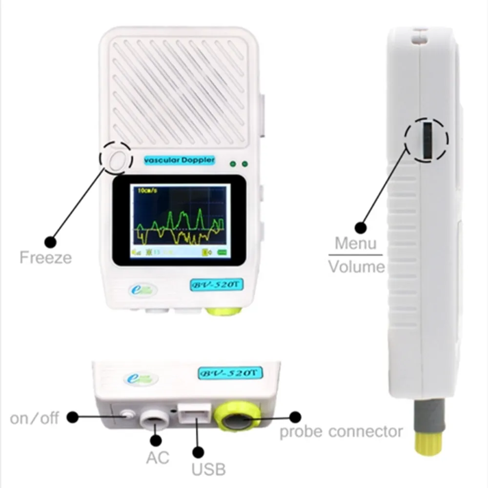 Detektor prędkości Vasuclar Doppler z sondą 8 MHz, detektor armii naczyniowej z przepływem krwi i 2,4-calowym TFT dla szpitala kliniki