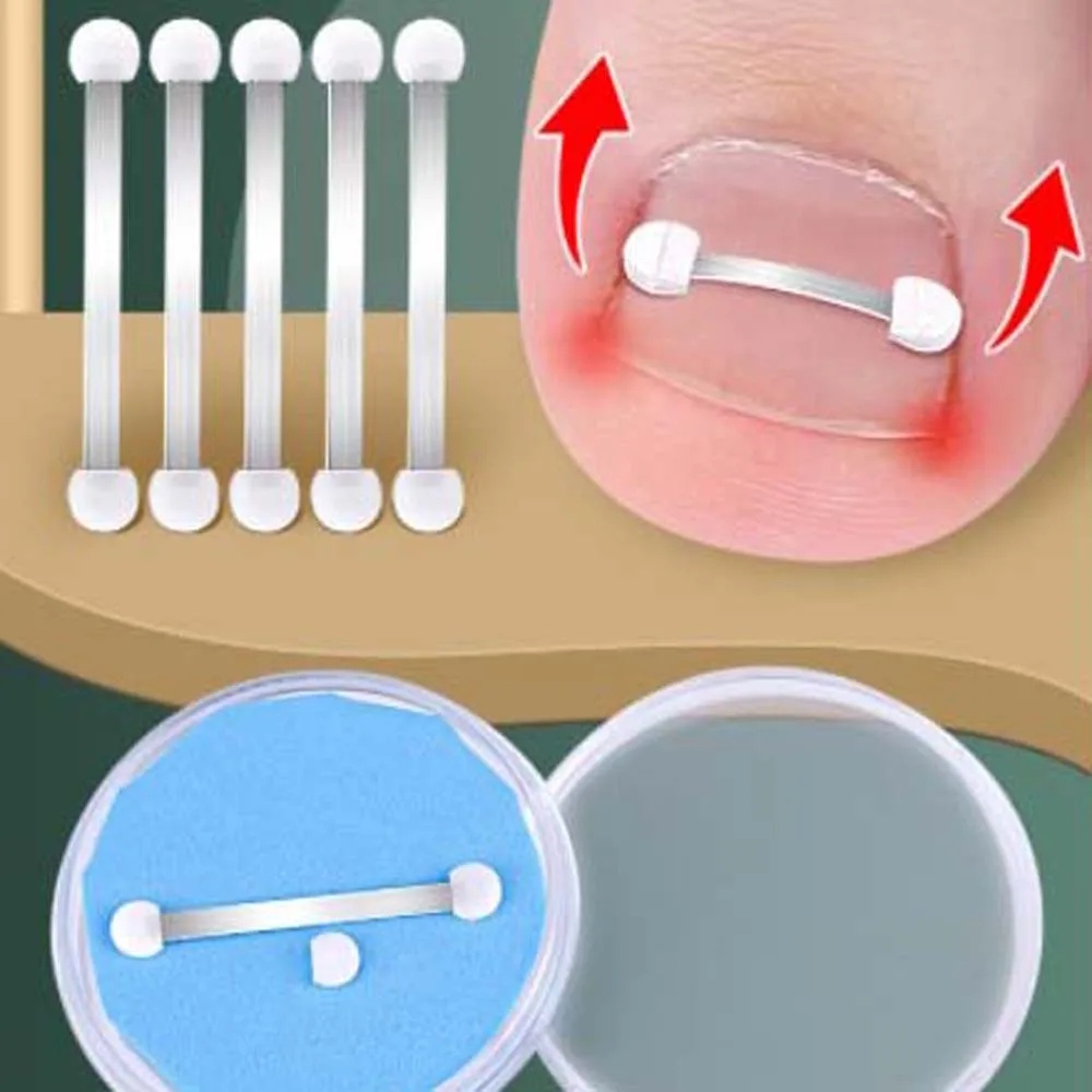 Toe Splint Support Toe Braces Pedicure Tool Ingrown Toenails Corrector Toenail Straightener Bunion Corrector Toenail Fixer