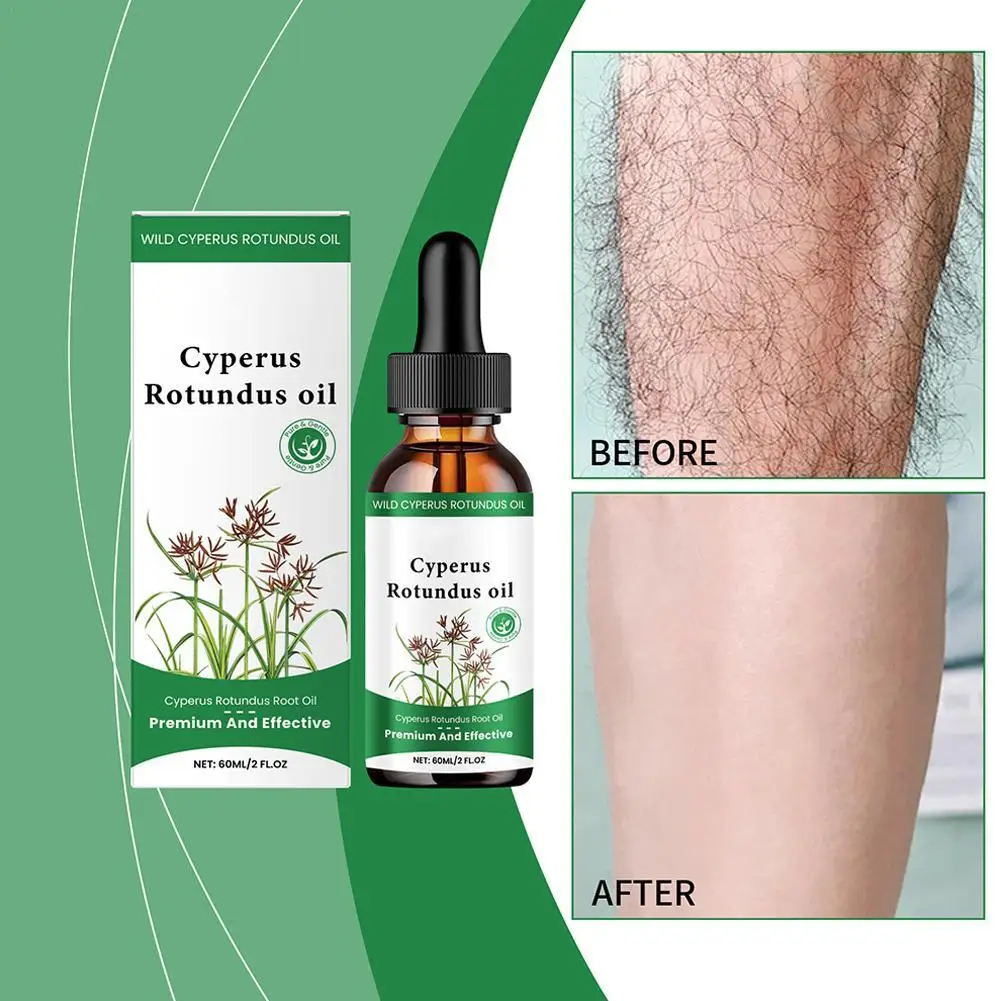 

Cyperus Rotundus Hair Removal Care Oil Cyperus Rotundus Plant Oil Body Moisturizing Nourishing Hair Removal Care Oil 60ml