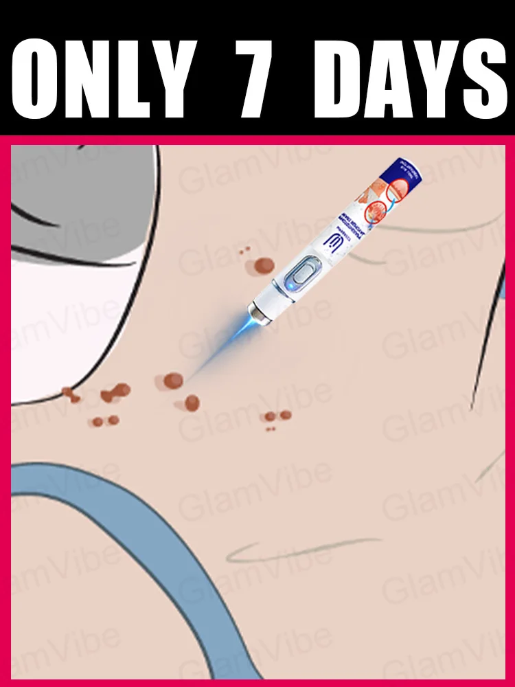

blue light pen solve warts, hot sale wart care tools