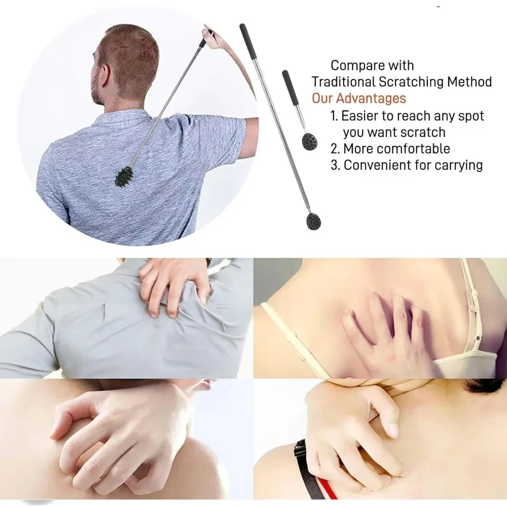 Adjustable Cactus Back Scratcher Massager - 2 Spike Sizes (0.25