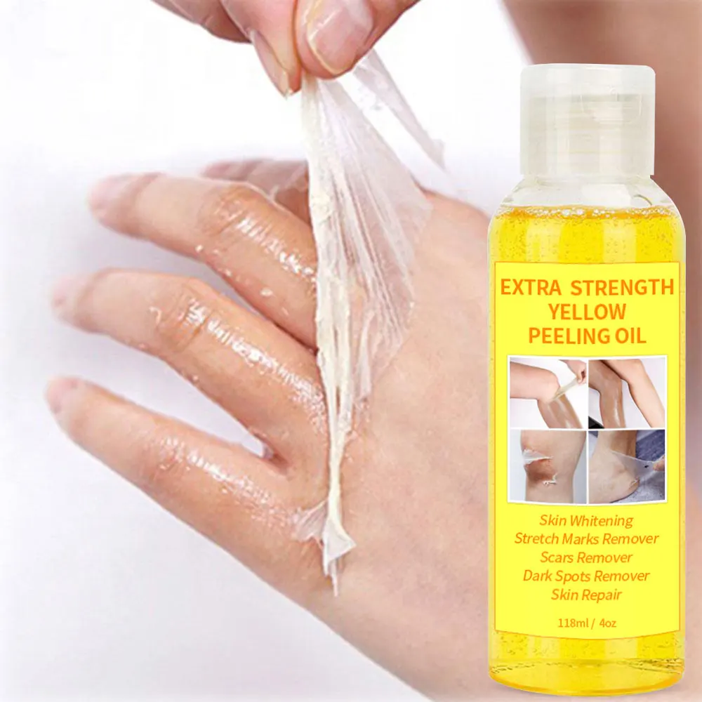 

Strong Peeling Oil Even Skin Tone Knuckle Whitening Extra Strength Yellow Peeling Oil for Dark Skin