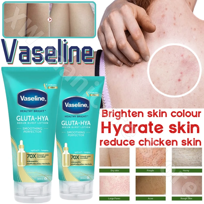 

300ml Thai Vaseline 70X Fruit Acid Body Lotion Brightens Skin Removes Dull Skin Smoothes Rejuvenates Refreshes and Is Not Greasy