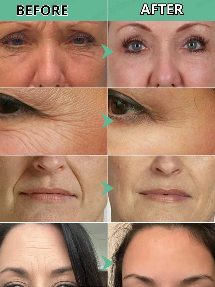 Anti Wrinkle Aging Instant Effect Remove Facial Wrinkles