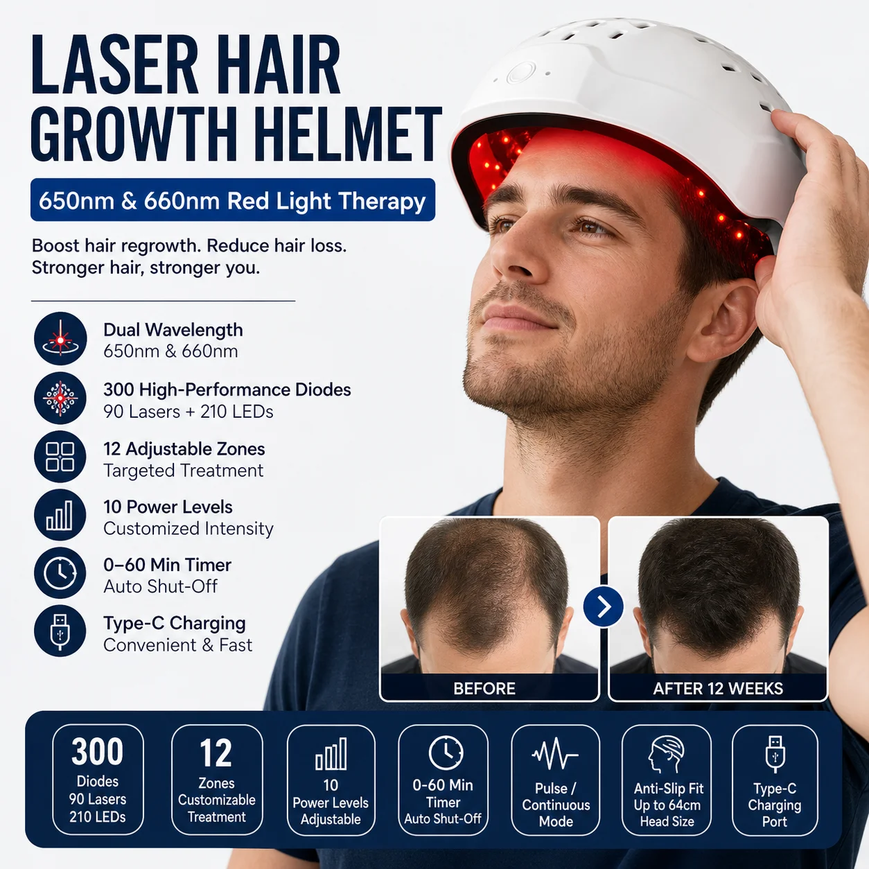 Medical-Grade Laser Hair Growth Cap: 90 Lasers + 210 LEDs, Non-Invasive Therapy with Adjustable Type-C Treatment Area & Duration