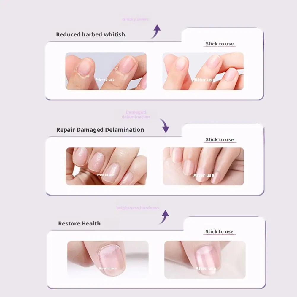 Olejek do skórek w pisaku na zapobieganie odrostom i wzmacnianie paznokci, nawilżająca pielęgnacja paznokci, przenośny pisak do naprawy suchej skórek.