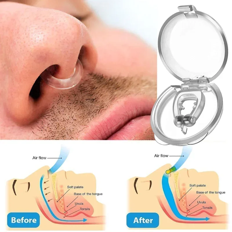 Dispositivo anti ronco de silicone, clipes de nariz, bandeja magnética para dormir, ajuda para melhorar o sono, fácil respirar, guarda de apneia, dispositivos noturnos