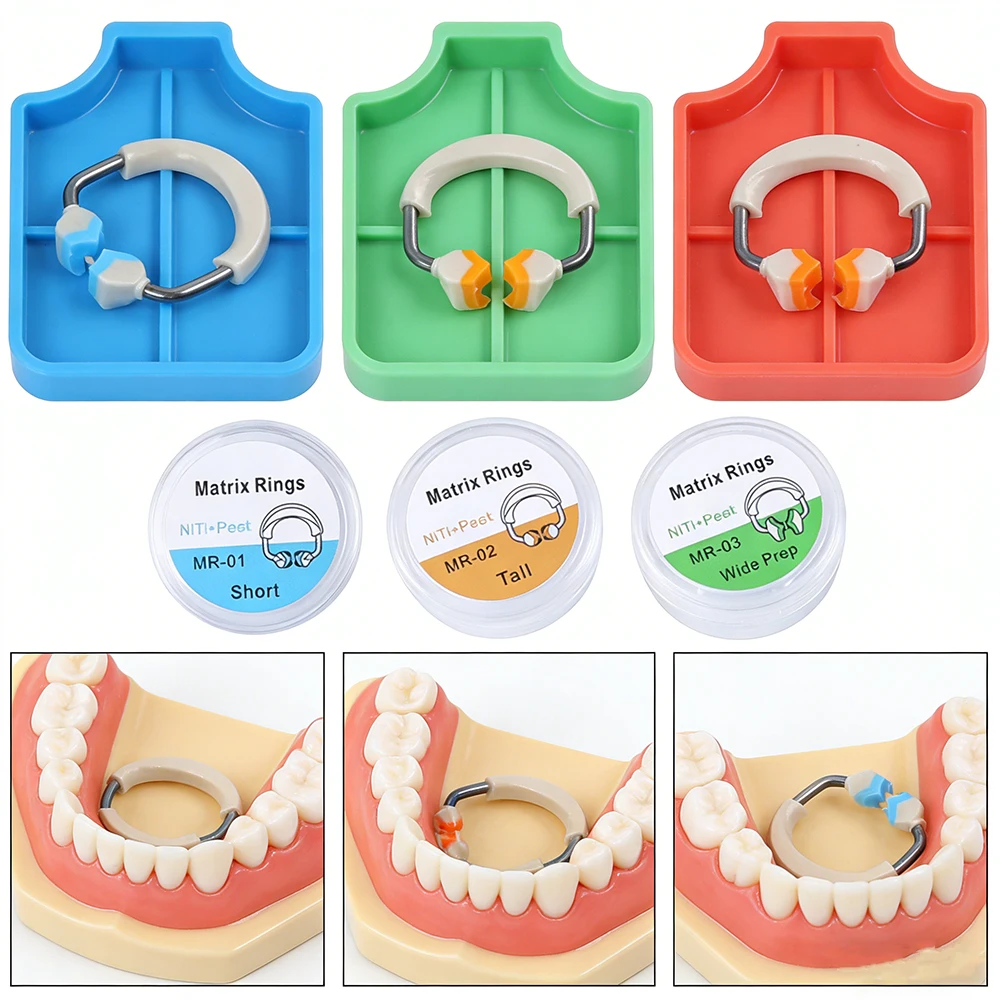 Dental Restorative Sectional Matrix System – Nitinol Niti Bands mit Clip Ring für hintere Zähne