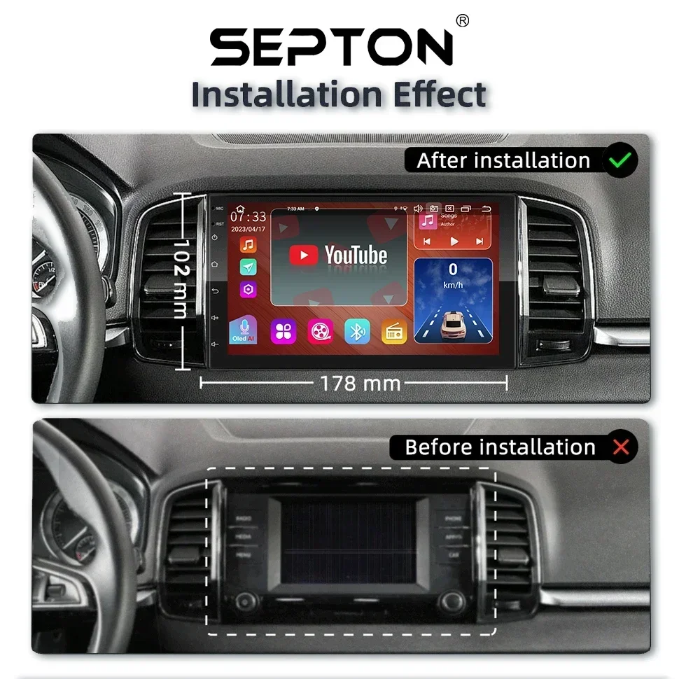 SEPTON Android Universal 7 9 10 13 Inch Car Radio Smart Car Systems for Volkswagen Nissan Hyundai Kia Toyota Kia 2Din  Car Audio