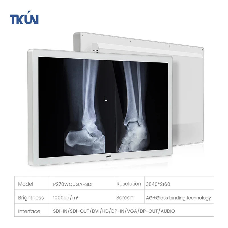 Factory Sales Radiology Monitor 27inch P270WQUGA-SDI 1000nits  High Resolution Anti-glare 8MP Medical Monitor