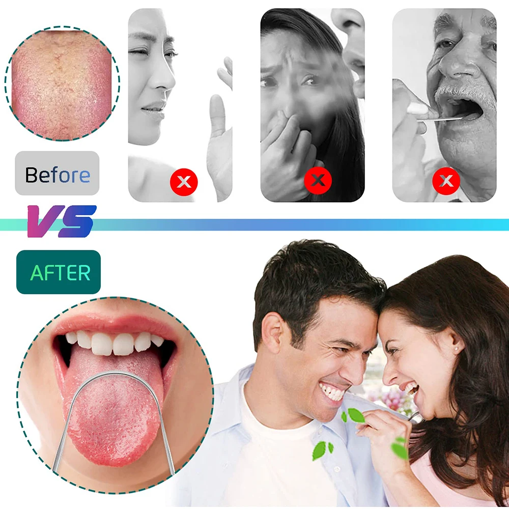 Thumbnail 2 - #23 Tongue Scrapers Deals & Discounts