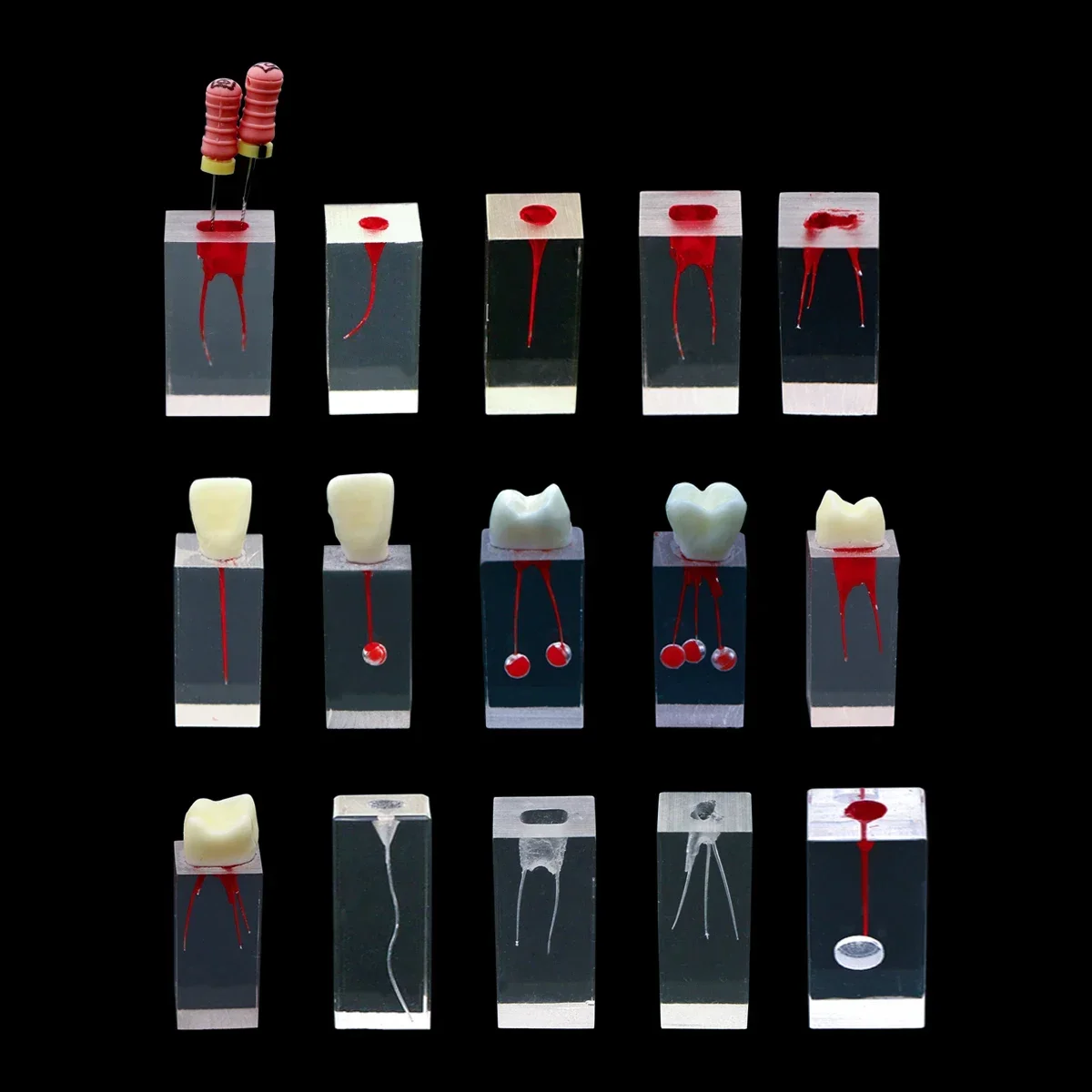 

Dental Teeth Model Endodontic Root Canal Teeth Study Model Endo Rotary Files Practice Block 1PC