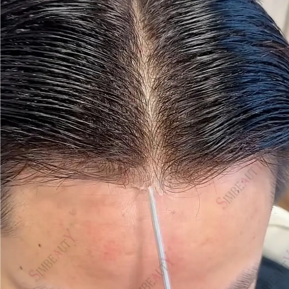 Male Hair Prothesis Super Natural Hairline Thin Skin0.02mm Base Toupee Men Black Grey Human Hair Undetectable Replacement System
