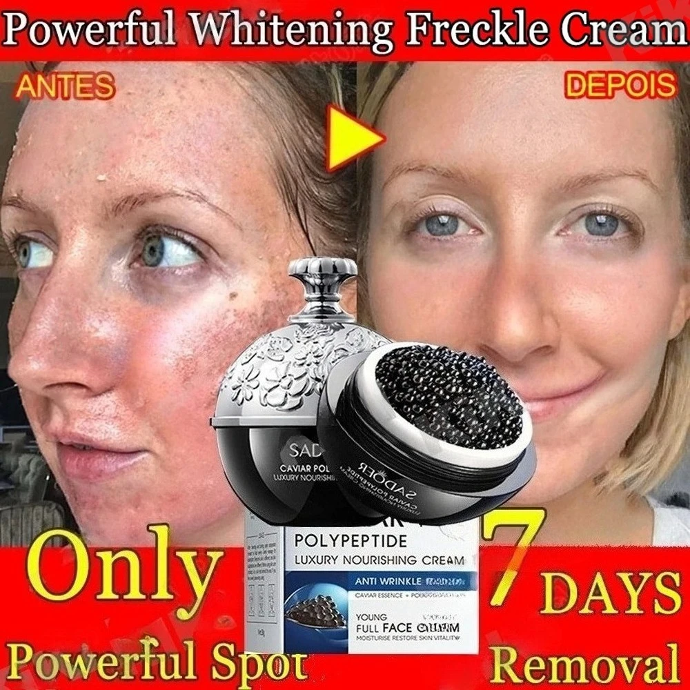 

Caviar Anti-Wrinkle Face Cream Collagen Anti-Aging Firming Lift Fade Fine Lines Moisturizing Smooth Brighten Skin Care Products