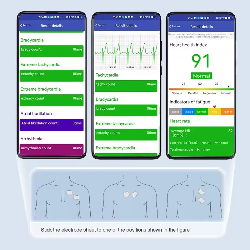 BOXYM tıbbi sarf malzemeleri tek kullanımlık kablosuz EKG elektrot açar yetişkin EKG elektrot elektrokardiyogram EKG yapışkan yama