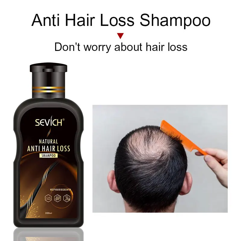 Sevich  Anti-Hair Loss Ginger Hair Shampoo 200ML Anti-Breakage Strong Hair Roots Hair Loss Treatment Shampoo