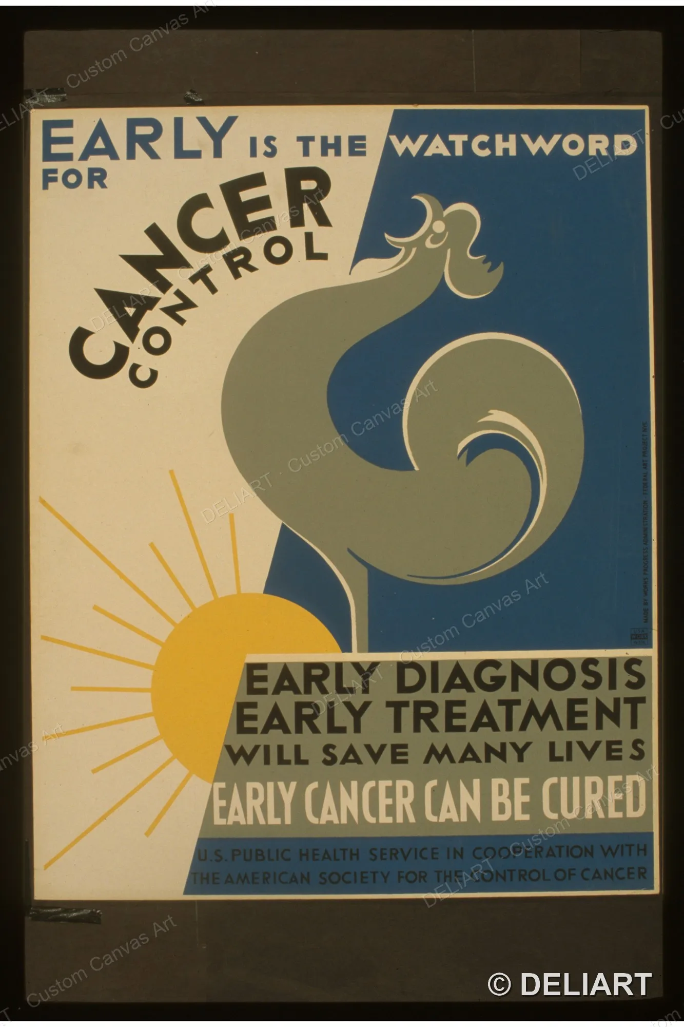 Early is the watchword for cancer control Early diagnosis Vintage WPA Public Health Canvas Wall Art Poster Print Unframed