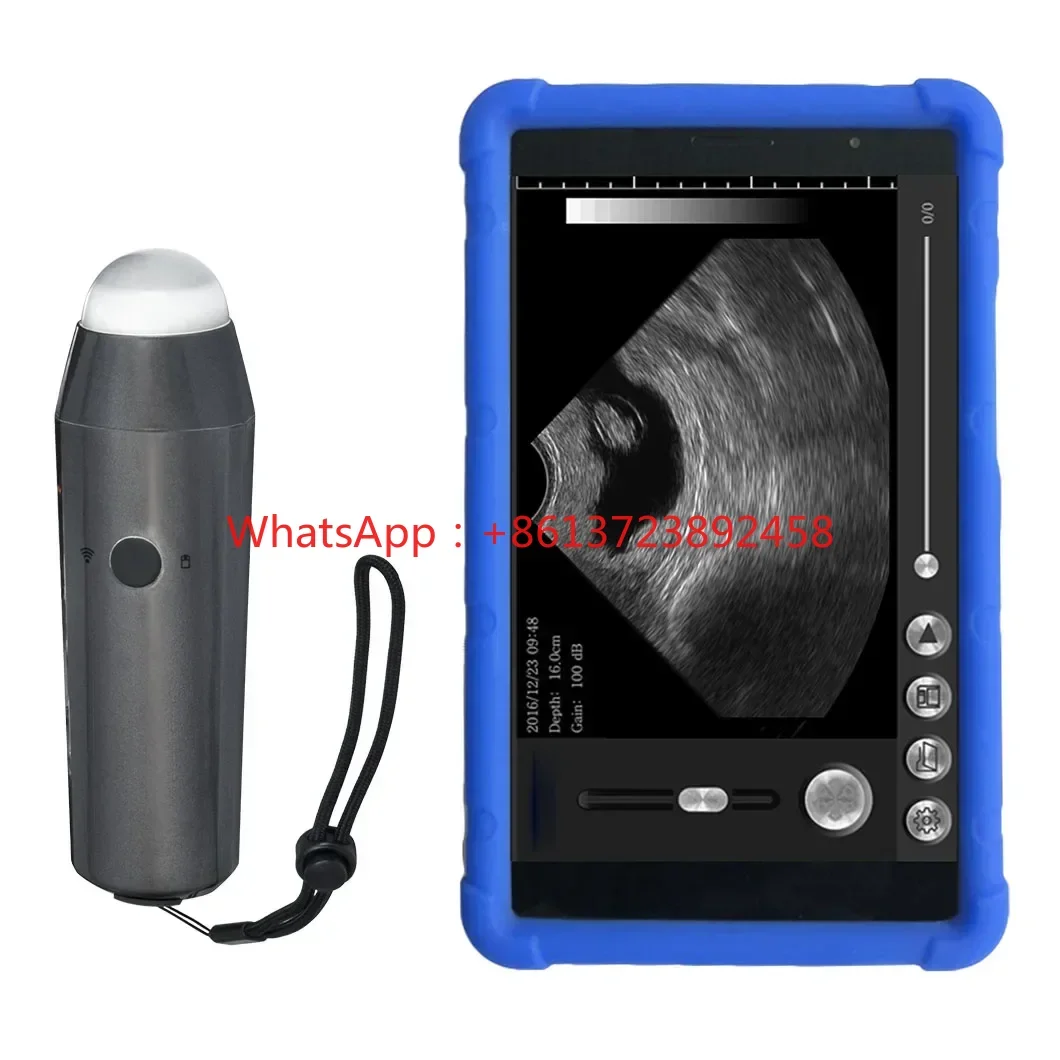 

High Quality Vet Handheld Mobile Ultrasound Android Wireless Ultrasound Probe