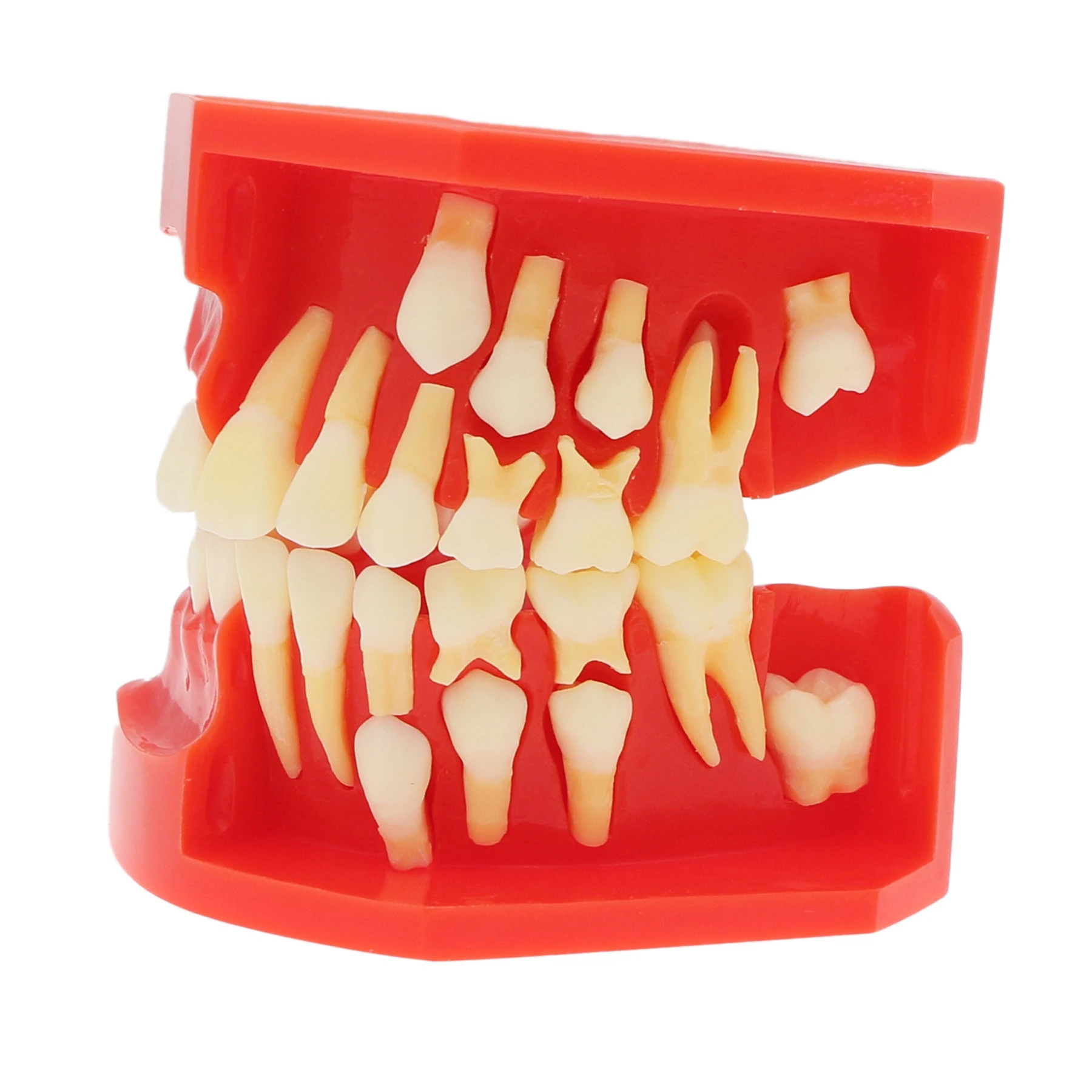 M7013 Mixed Dentition Teeth Model Removable Red Gum Jaw Primary Permanent Mixed Tooth Development Demonstration Model