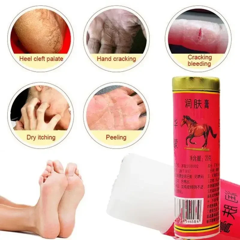 1Pcs 20g Horse Oil Skin Cream Anti-cracking Ointment Prevents Dry Skin Moisturizes Protects Fingers Feet And Skin Care Products