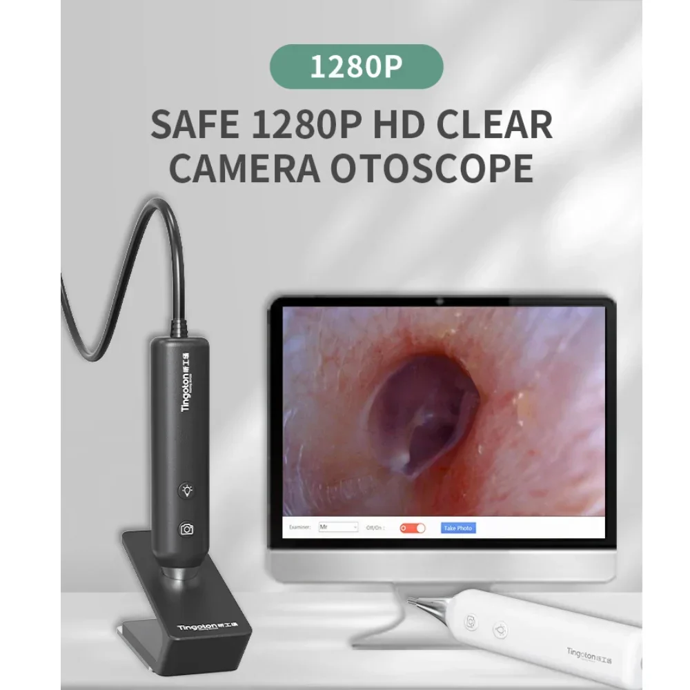 Otoscope Ear Camera Digital Image Capture 1280P HD Ear Scope with Light Intensity Adjustment Ransfer Files Through Computer