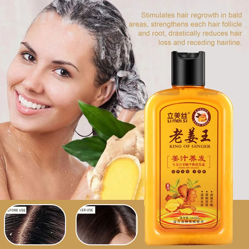 280ml Gember Haar Snelle Groei Shampoo Conditioner Anti-Haaruitval Pure Plantaardige Shampoo Haarverzorging Olie Controle roos Zacht