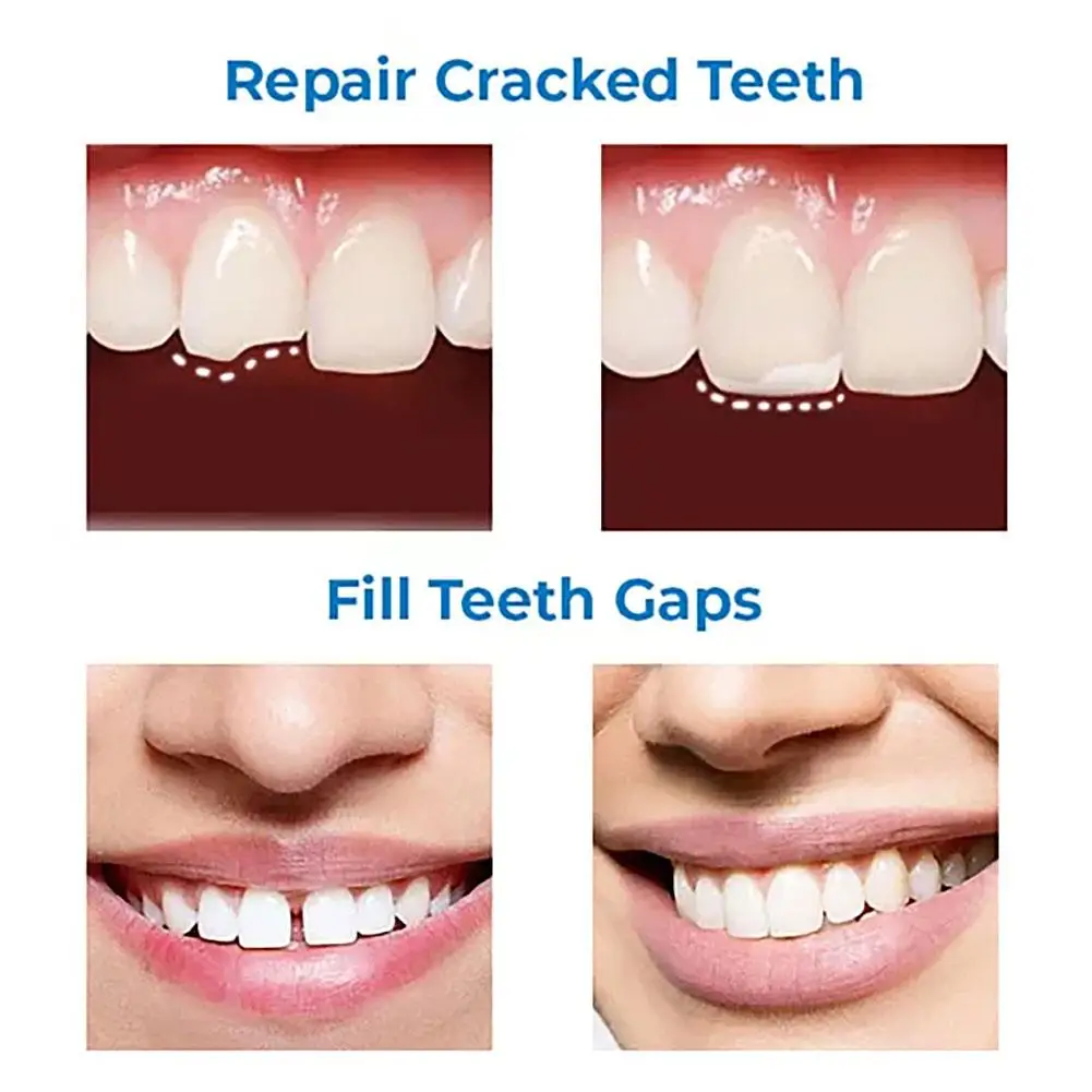 Colla per la riparazione dei denti 30ml per il fissaggio delle sostituzioni dei denti mancanti e rotti Kit di riparazione dentale per denti finti modellabili temporanei