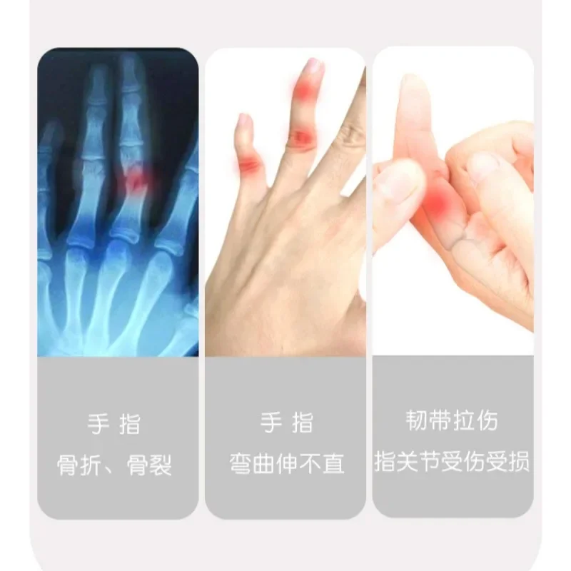 Finger Splint Hand Trigger Broken Finger Sprain Joint Arthrodesis Fracture Pain Relief Finger Support Brace Thumb Protector