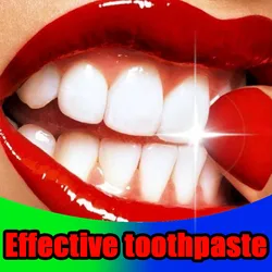 Dental Calculus Remover Whitening Brightening Preventing Periodontitis Teeth Toothpaste