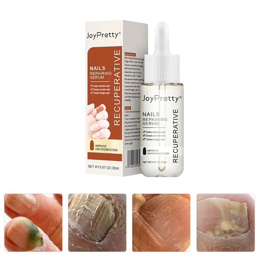 20Ml Nagelreparatie Vloeibare Nagels Serum Vingernagel Oplossing Teennagel Voedende Kracht Zorg Essentie Reparatie Beschadigde Groei Uña 'S