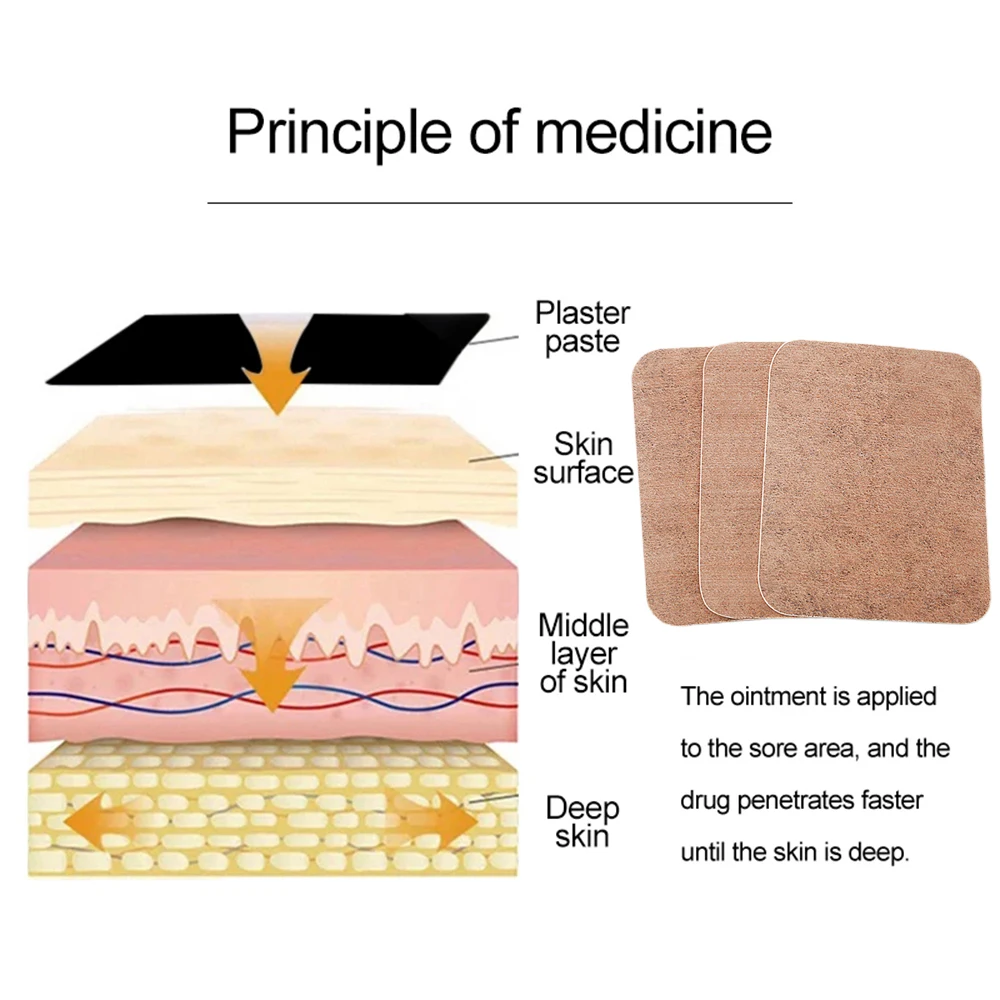 Pâte de moxibustion à l'absinthe pour garder les articulations du corps au chaud, autocollant articulaire auto-chauffant, patchs à base de plantes, vertèbres cervicales, genou, 12 pièces