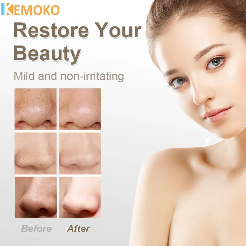 5 em 1 removedor de cravo elétrico aspirador de acne remoção de manchas pretas facial limpeza profunda poros facial nariz limpador