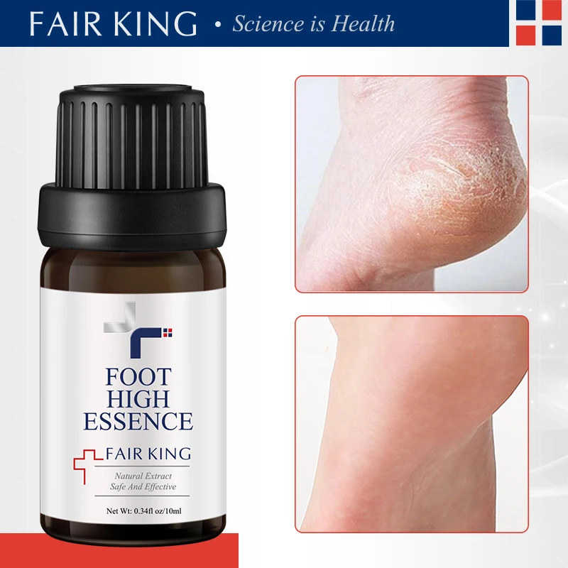 Plant Foot heightening Essential Oil Promote Height Growth Oil Body Care Soothing Foot Health Skin Care Promot Bone Growth Oil