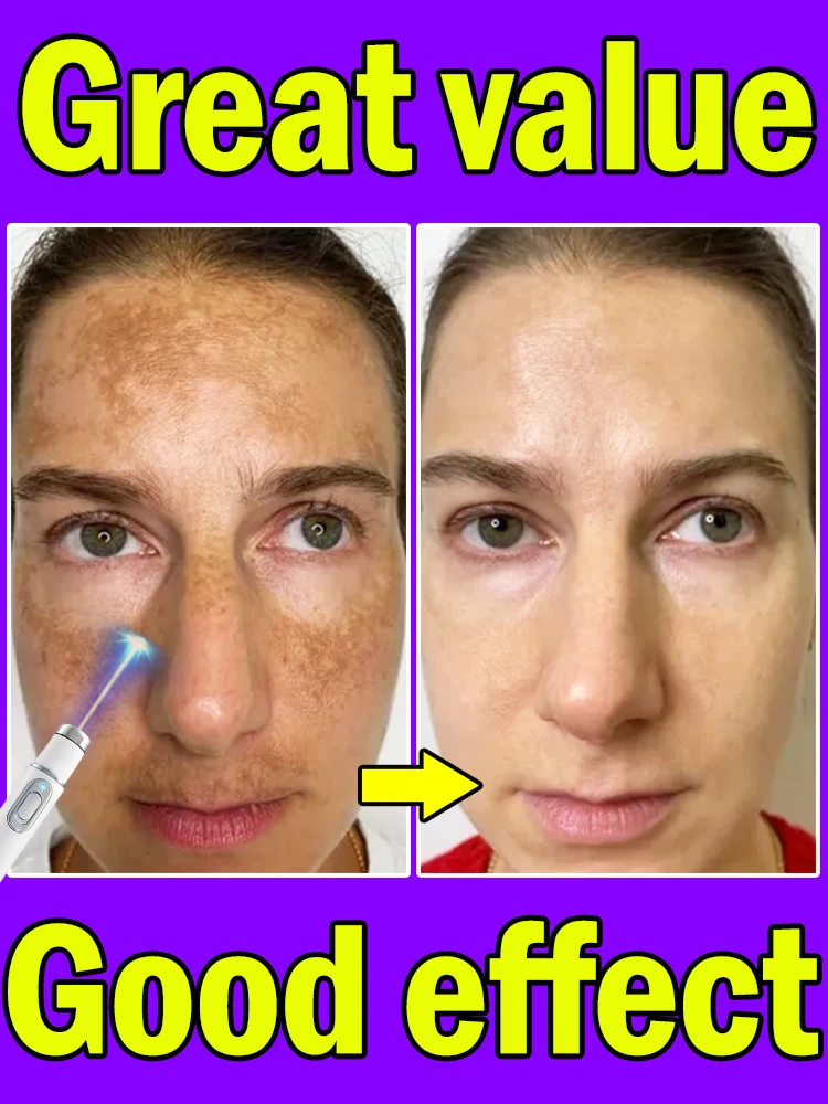 

Improve facial dark spots