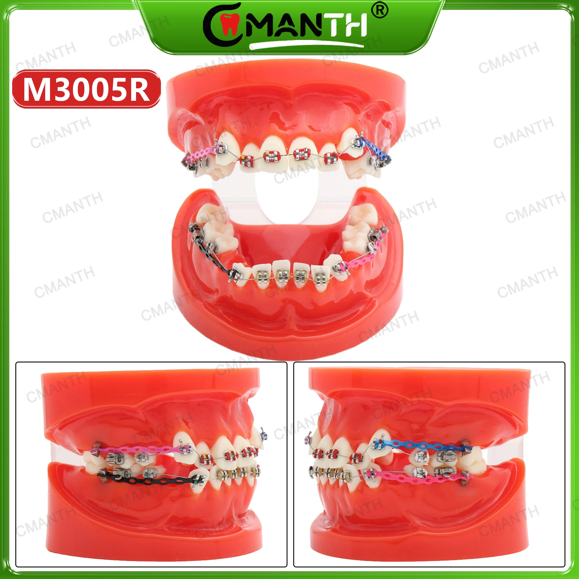

Dental Teeth Model with Orthodontic Bracket Tubes Ligature Tie Chain Teaching Model Fit Dentist Treatment Demo Training M3005R