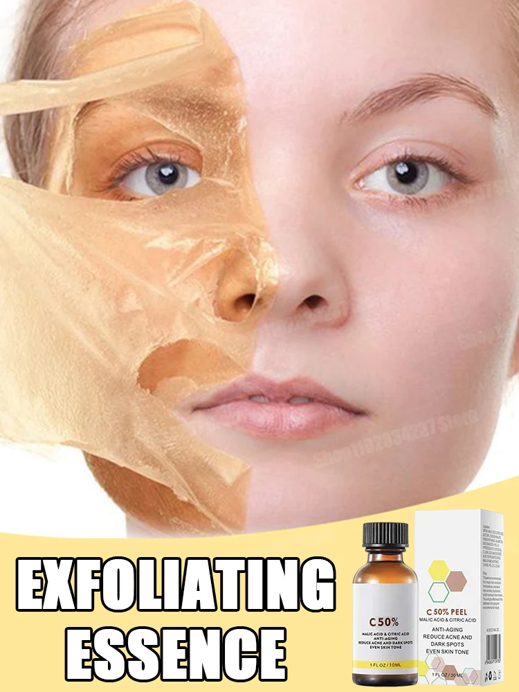 Facial Exfoliating Serum Skin Cleansing Fades Dark Spots and Pigmentation for Brighter Skin