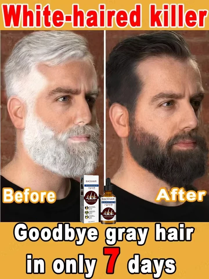 White hair killer, remove gray hair and restore natural hair color in 7 days