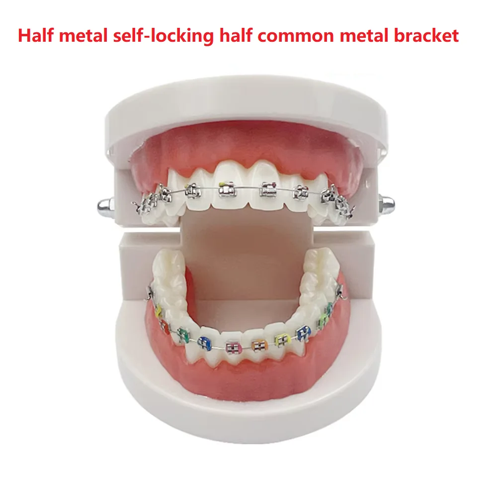 Dental Teaching Model Standard Dental Orthodontic Teeth Model With Braces Metal / Ceramic Brackets For Dentistry Education Study