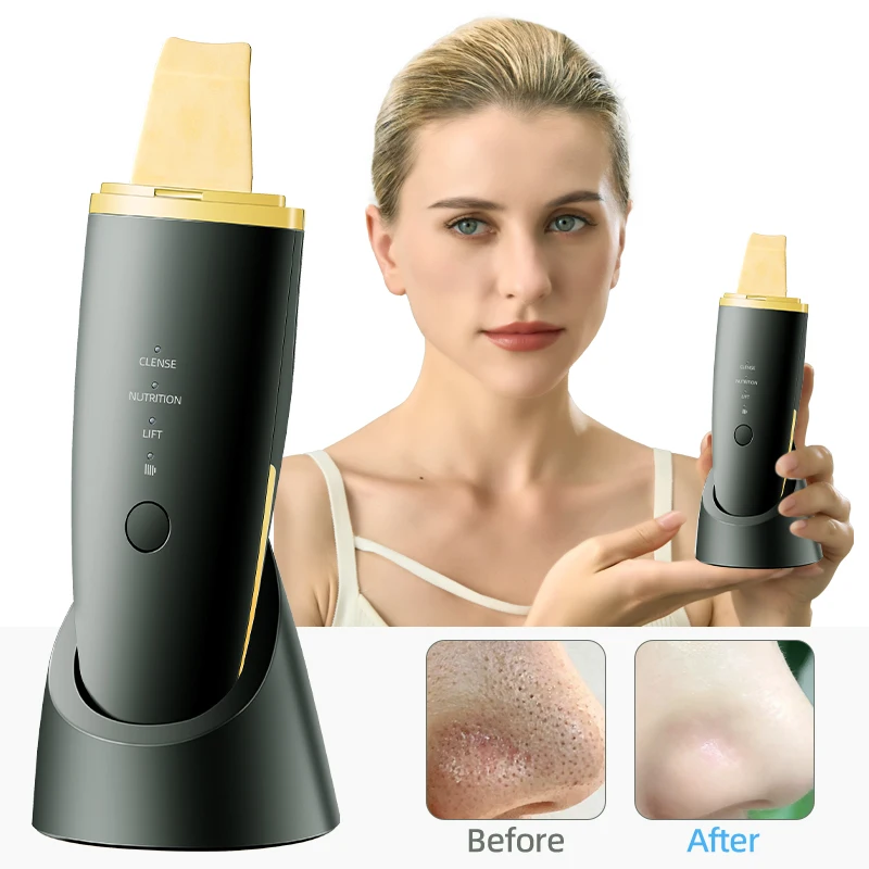 Nieuwe Ultrasone Huid Scrubber Trillingen Gezicht Spatel Comedondrukker Schop Schoon Cavitatie Peeling Facial Lifting EMS Machine
