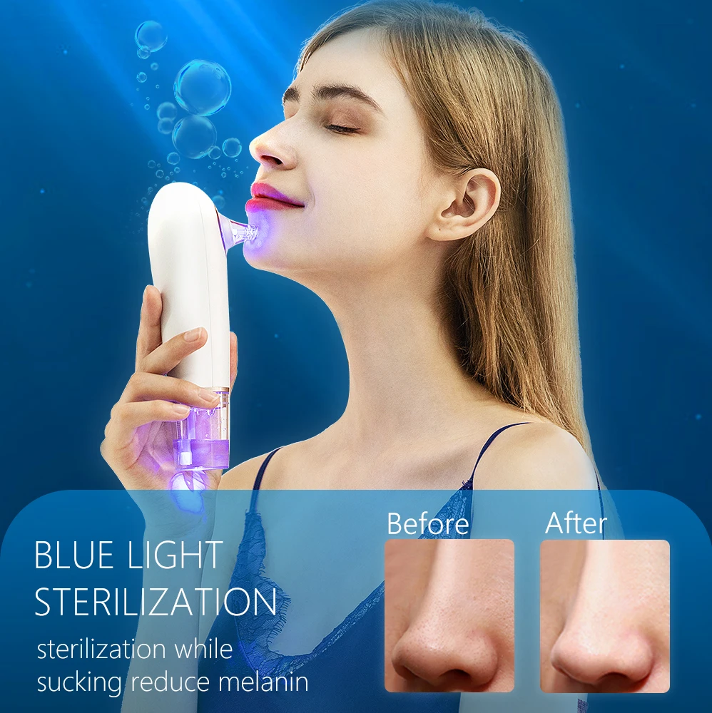 Nettoyeur de pores électrique  - Blackhead Remover Vacuum Suction avis et prix