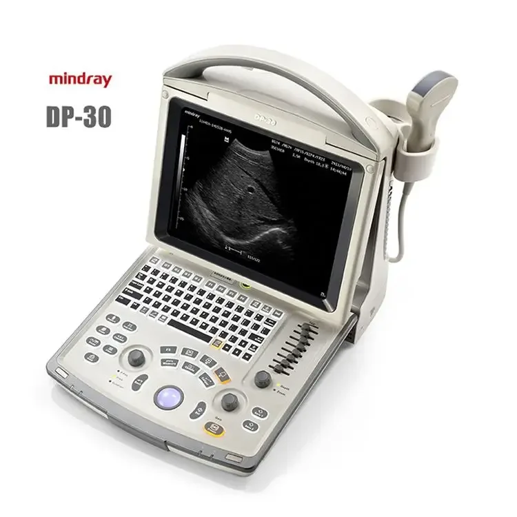 Mindray DP-30 4d ultrasound portable laptop doppler ultrasound scanner