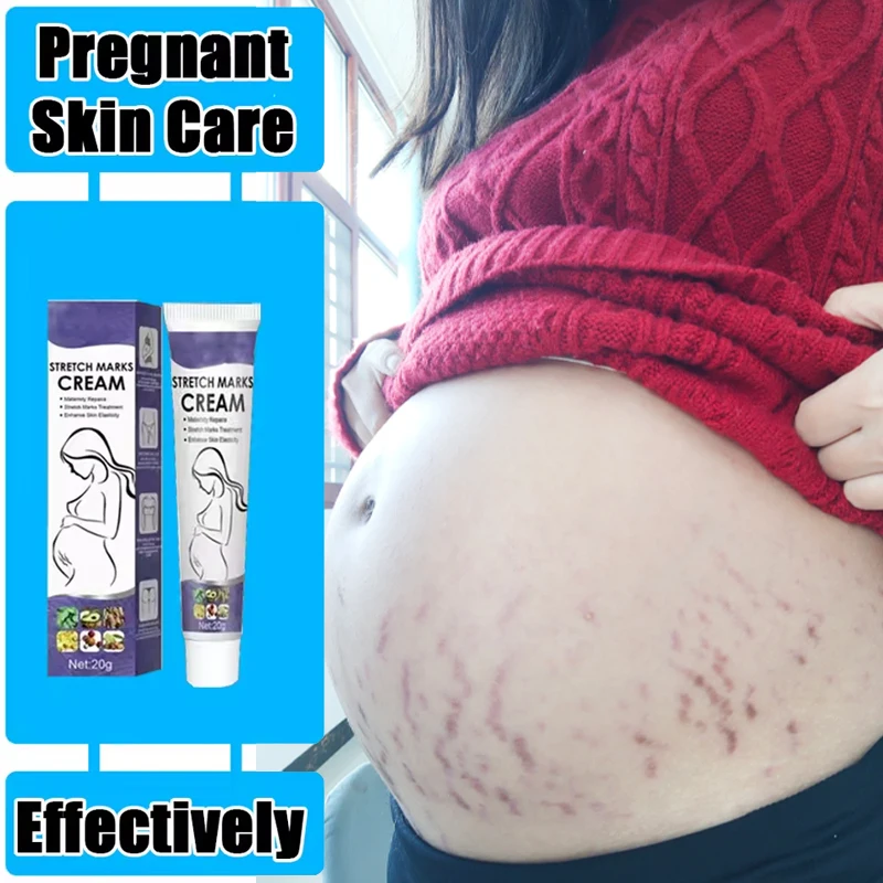 

Stretch Mark Repair Cream For Pregnant Women Postpartum Care Firm Light Lines Obesity Lines Growth Lines Repair Cream New