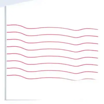 

8 Pcs Yangqin Tube Rubber Band Chinese Music Instrument Repair Part Dulcimer Replacement Parts